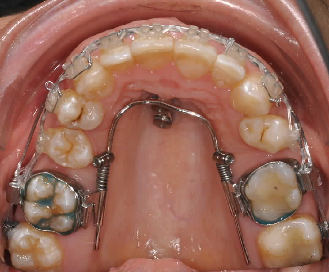 9213_Abida_Saida_w_31_10_1974_135129_ZB-2_PJawUp_2016_03_17_09_41_00