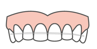 icons-kfo-graf-retainer